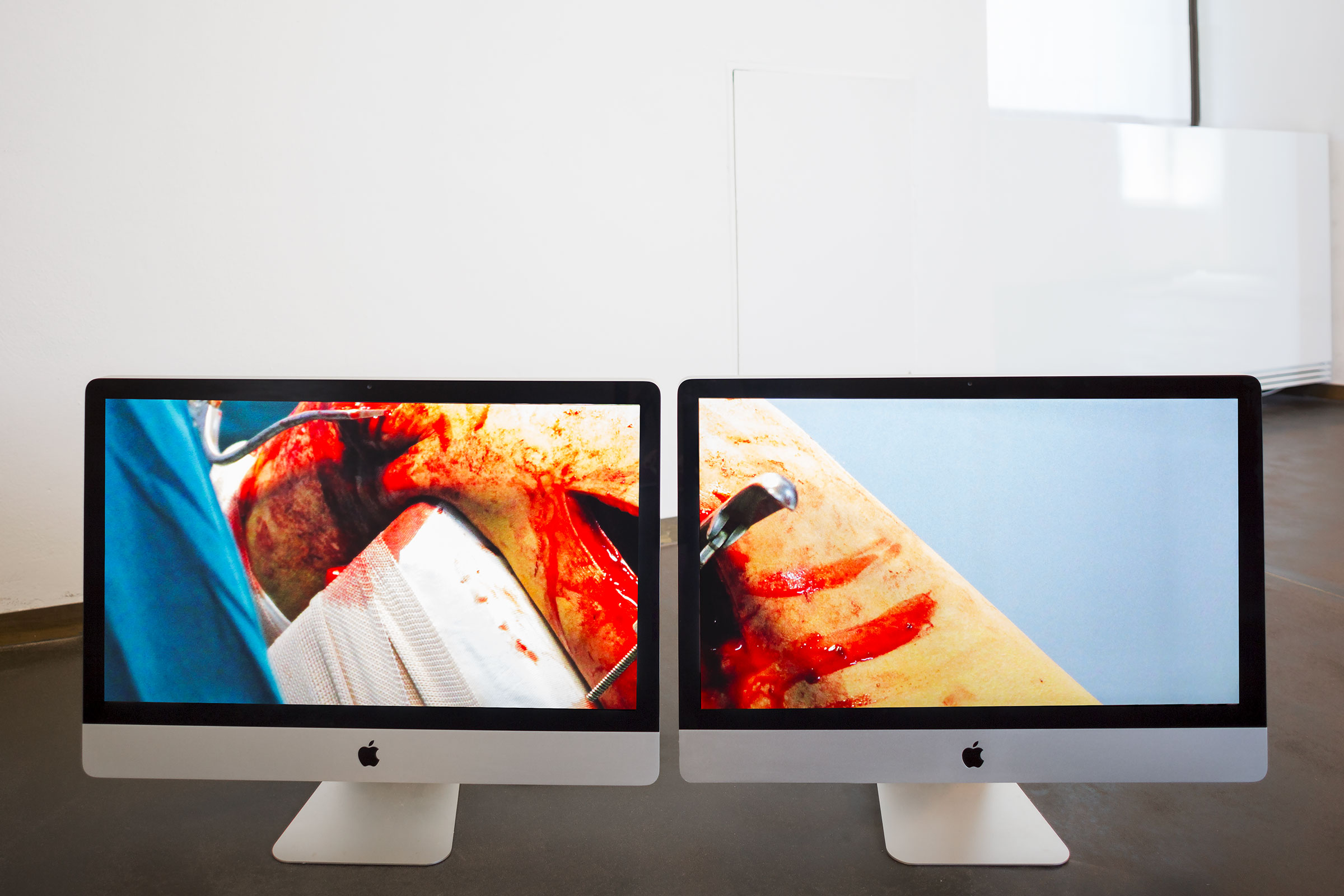 Massimo Grimaldi, Emergencyu0027s Surgical Centre u0027Ilaria Alpiu0027 In Battambang, Photos Shown on two Apple iMac Core 2 Duos, 2010